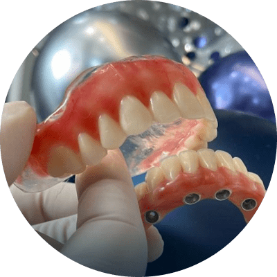 Implantes-min Dentista em Balneário Camboriú - Rise - Clínica Odontológica