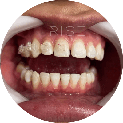 Orto-min Dentista em Balneário Camboriú - Rise - Clínica Odontológica