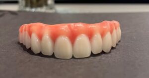 Read more about the article Quais são as principais causas de perda de implantes?